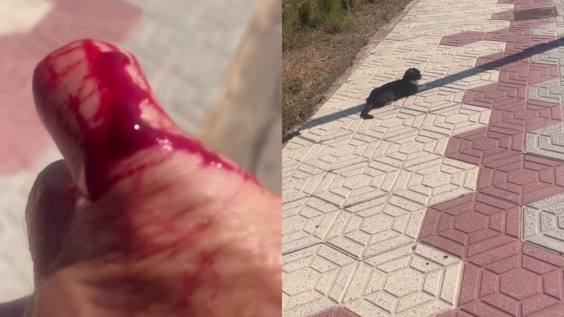 Las heridas de Maite Galdeano