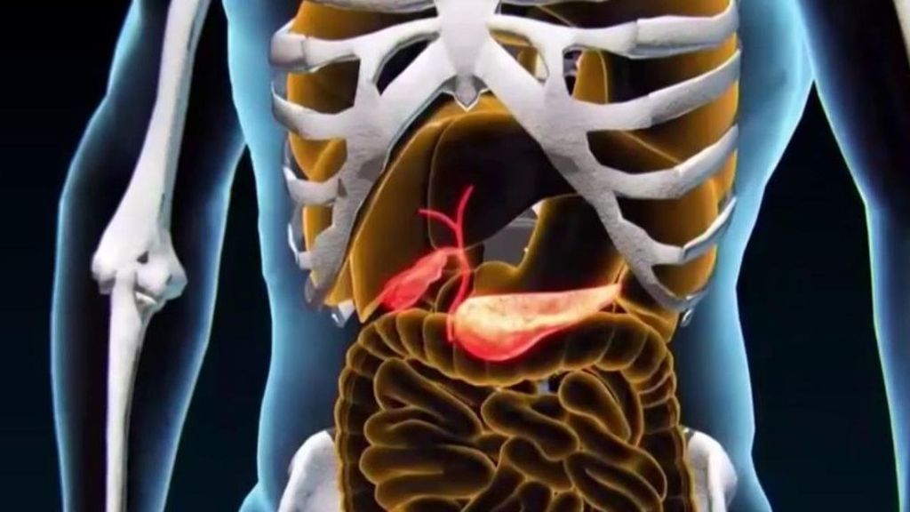 Daraxonrasib, una pastilla al día, la terapia que duplica la superviviencia del cáncer de páncreas avanzado