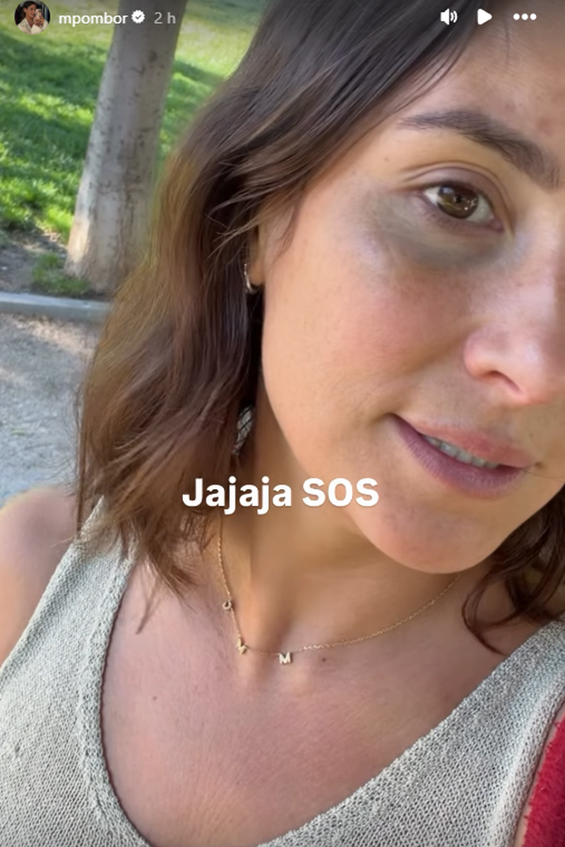 Marta Pombo enseña su ojo morado