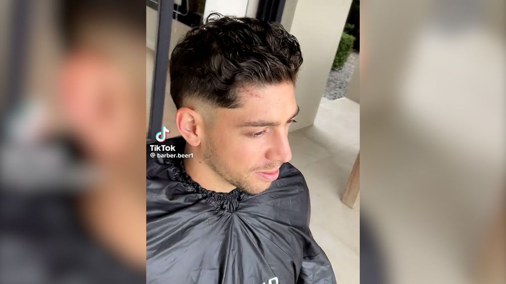 El peluquero de Fede Valverde 'filtra' la primera imagen de su frente tras la pelea