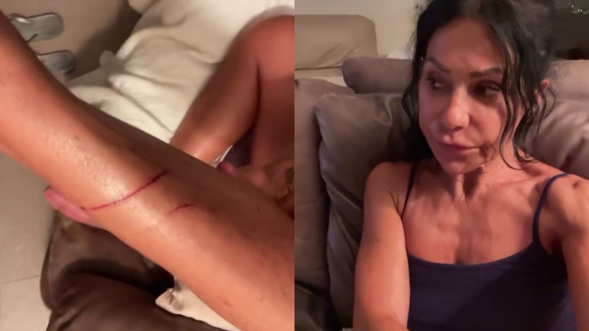 Las heridas de Maite Galdeano tras el nuevo ataque de la gata