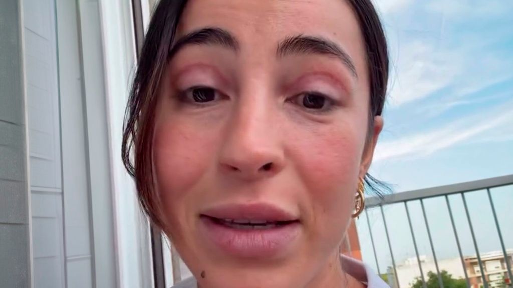 Ana López se somete a una blefaroplastia: el resultado