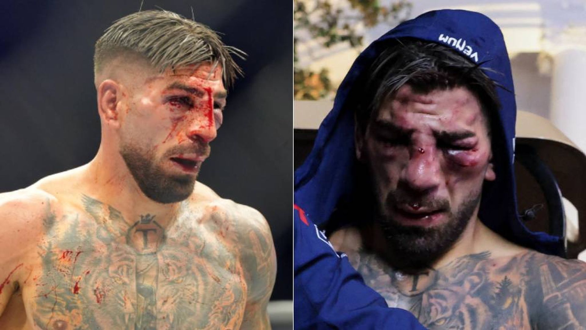 La cara de Ilia Topuria tras el aluvión de golpes de Justin Gaethje en su derrota en la Casa Blanca delante de Donald Trump