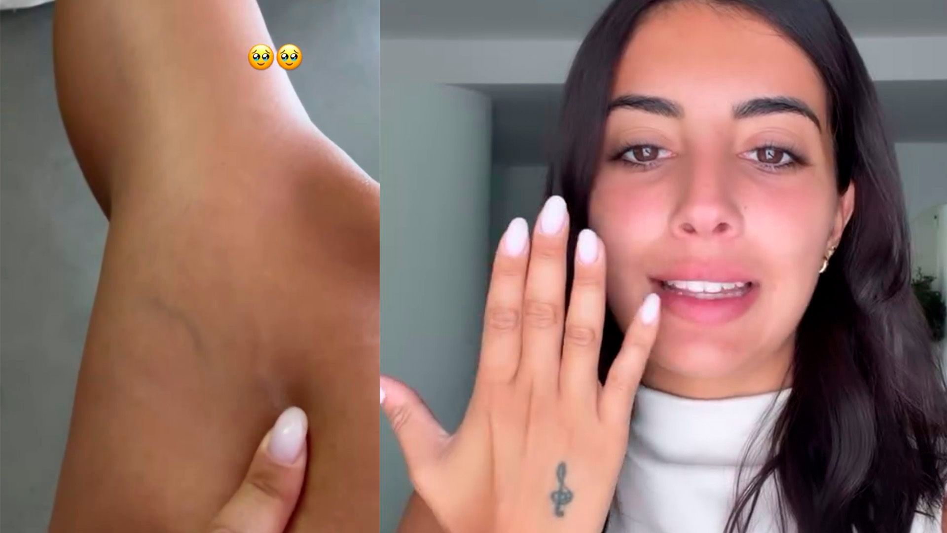 Marieta enseña el problema que tiene en sus extremidades