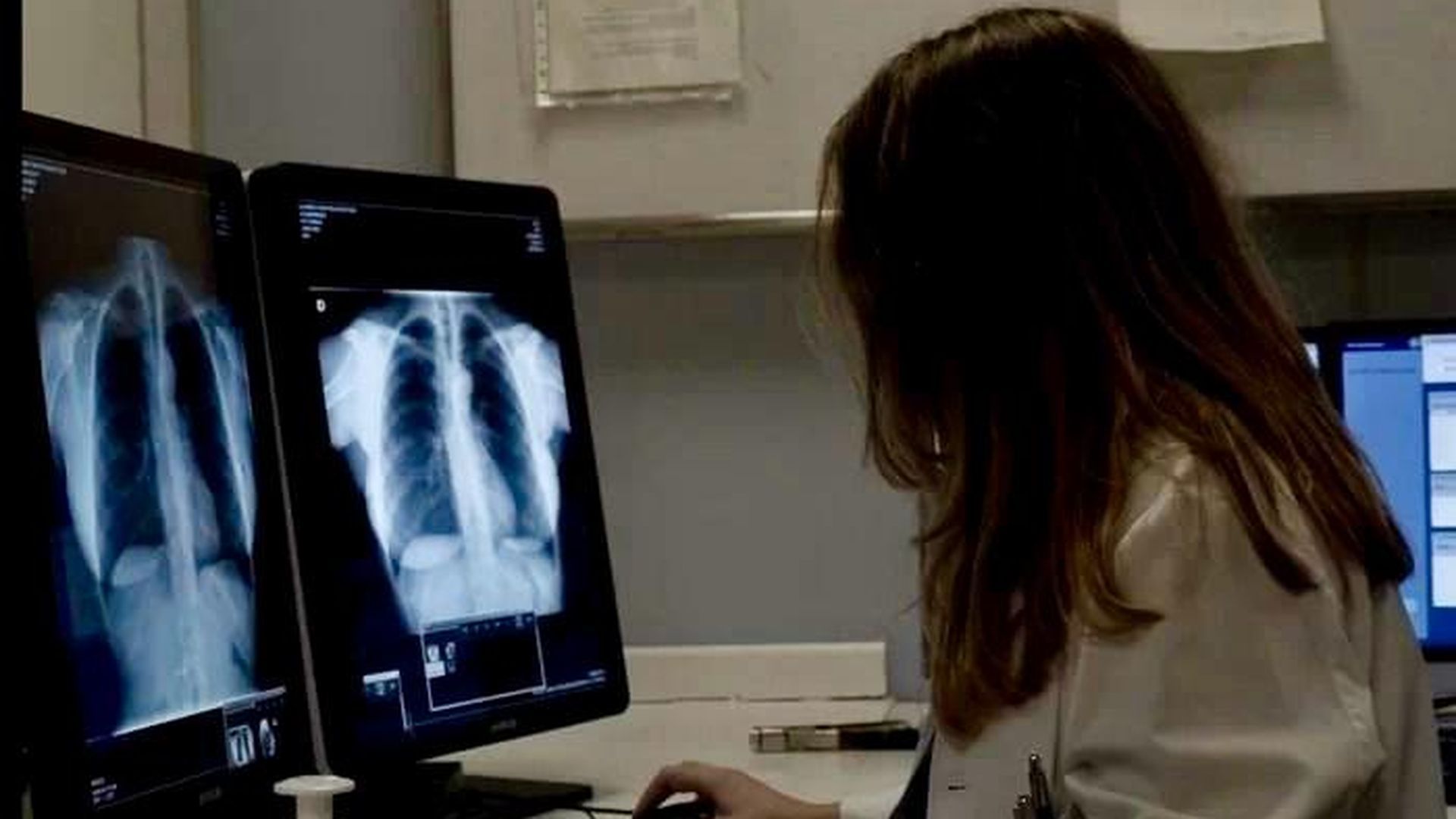 Una sanitaria de Osakidetza observa una radiografía Una sanitaria de Osakidetza observa una radiografía