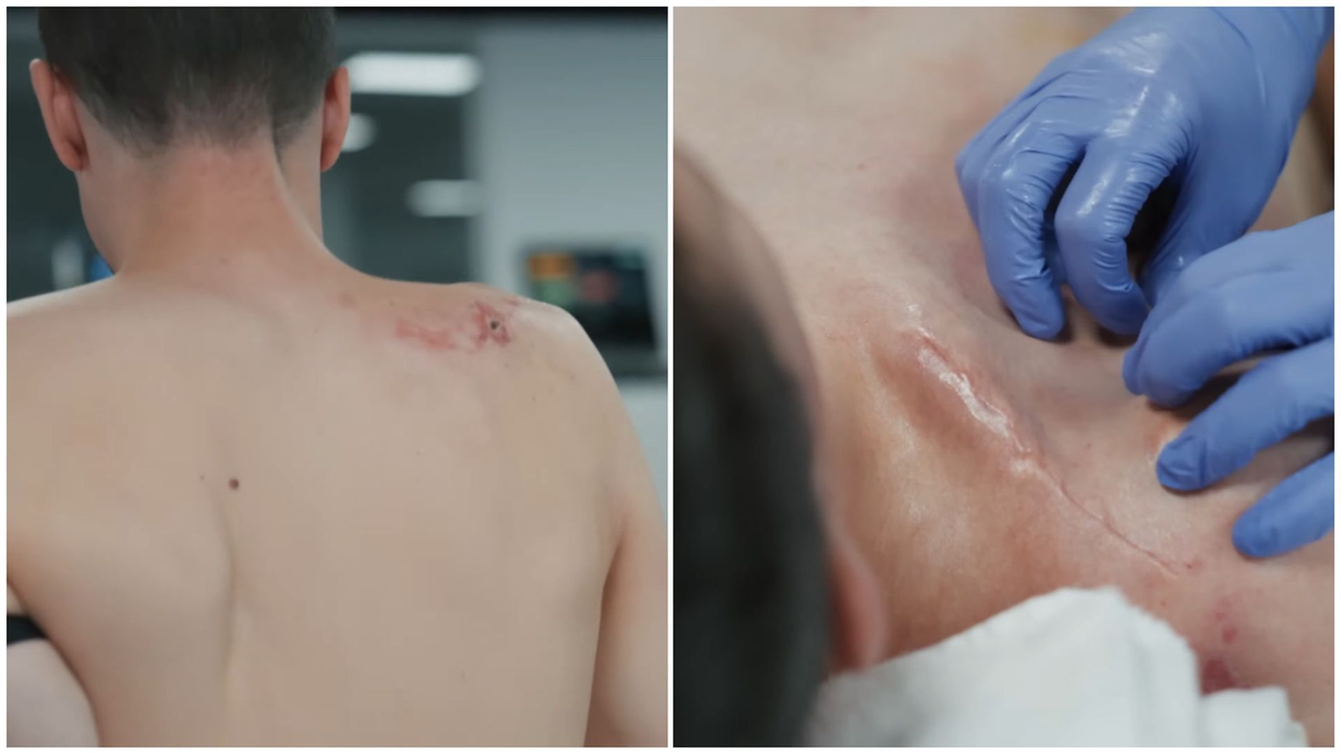 Álex Márquez, recuperándose