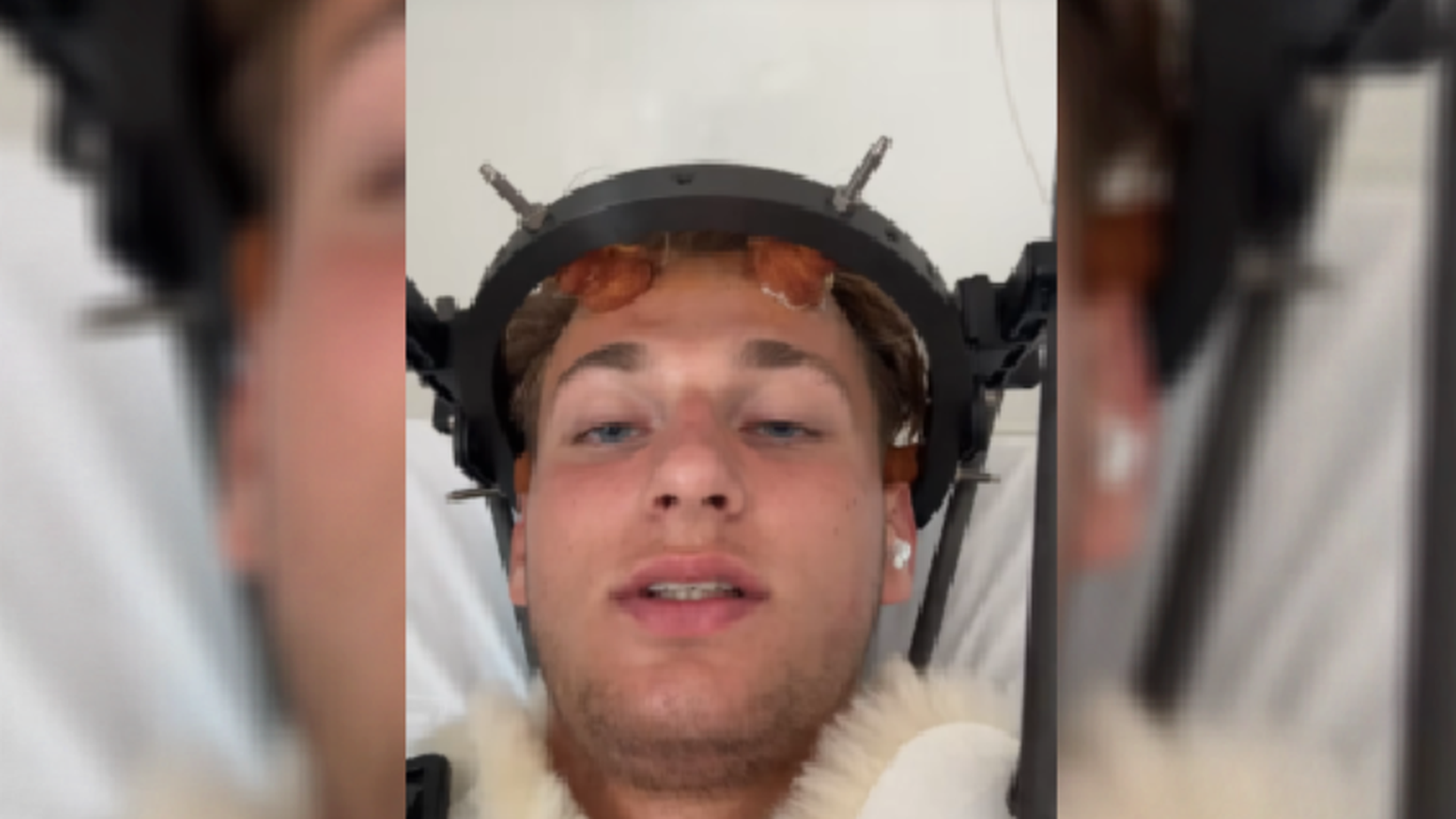 El futbolista de 21 años, Max Dettmann, sufre una grave lesión cervical tras lanzarse de cabeza a una piscina en Mallorca