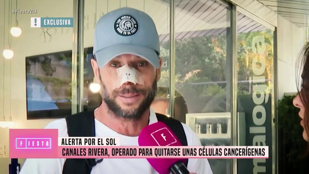 José Antonio Canales Rivera, operado para quitarse unas células cancerígenas en la nariz por culpa del sol