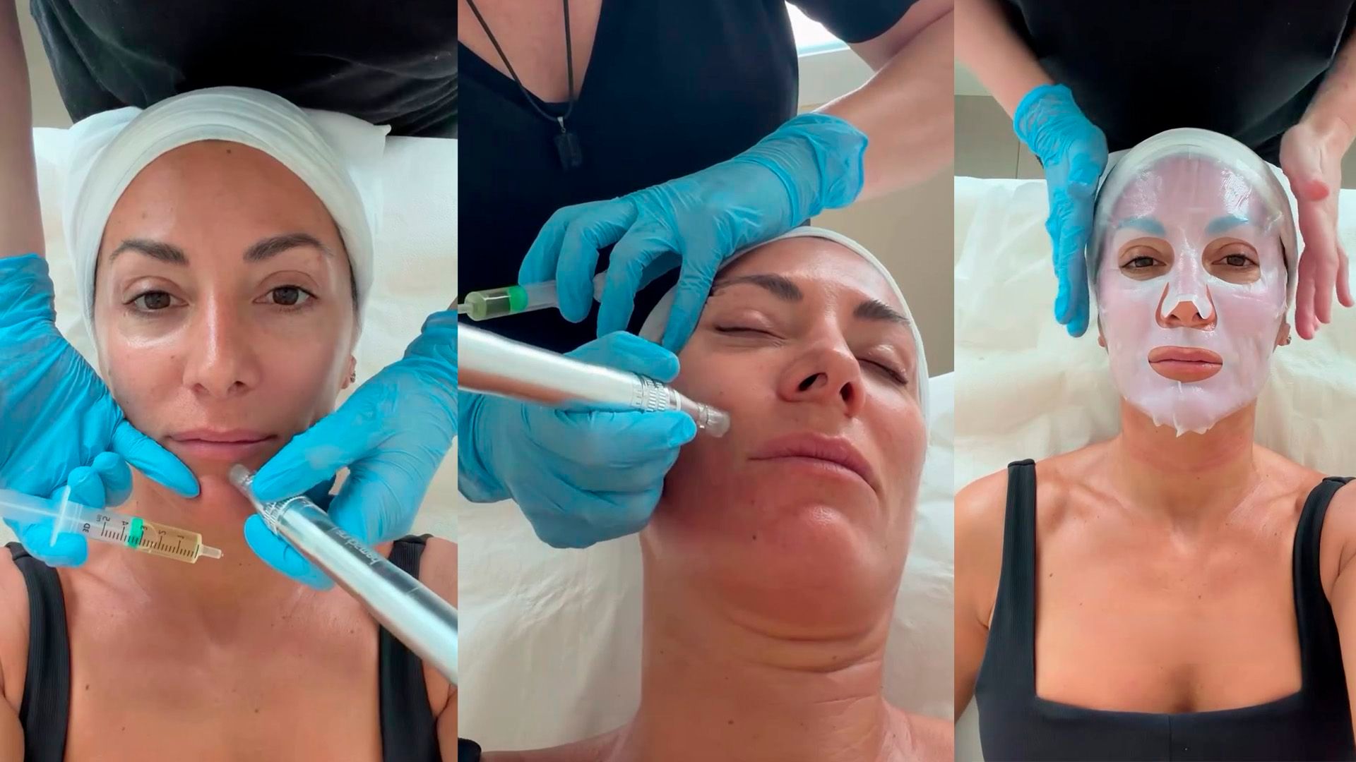 Nagore Robles realizándose el tratamiento