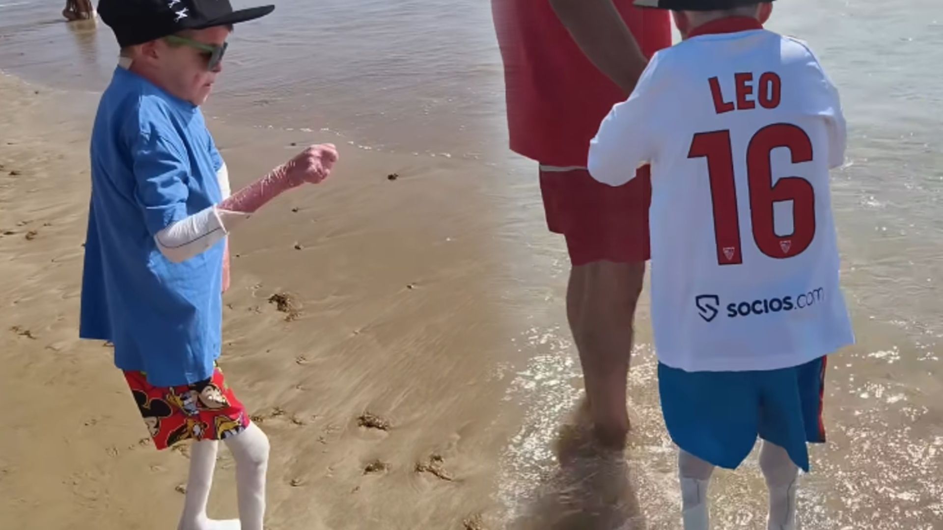 Leo, el niño con piel de mariposa, sorprende dando sus primeros pasos en el mar: "Le tiene un respeto tremendo"