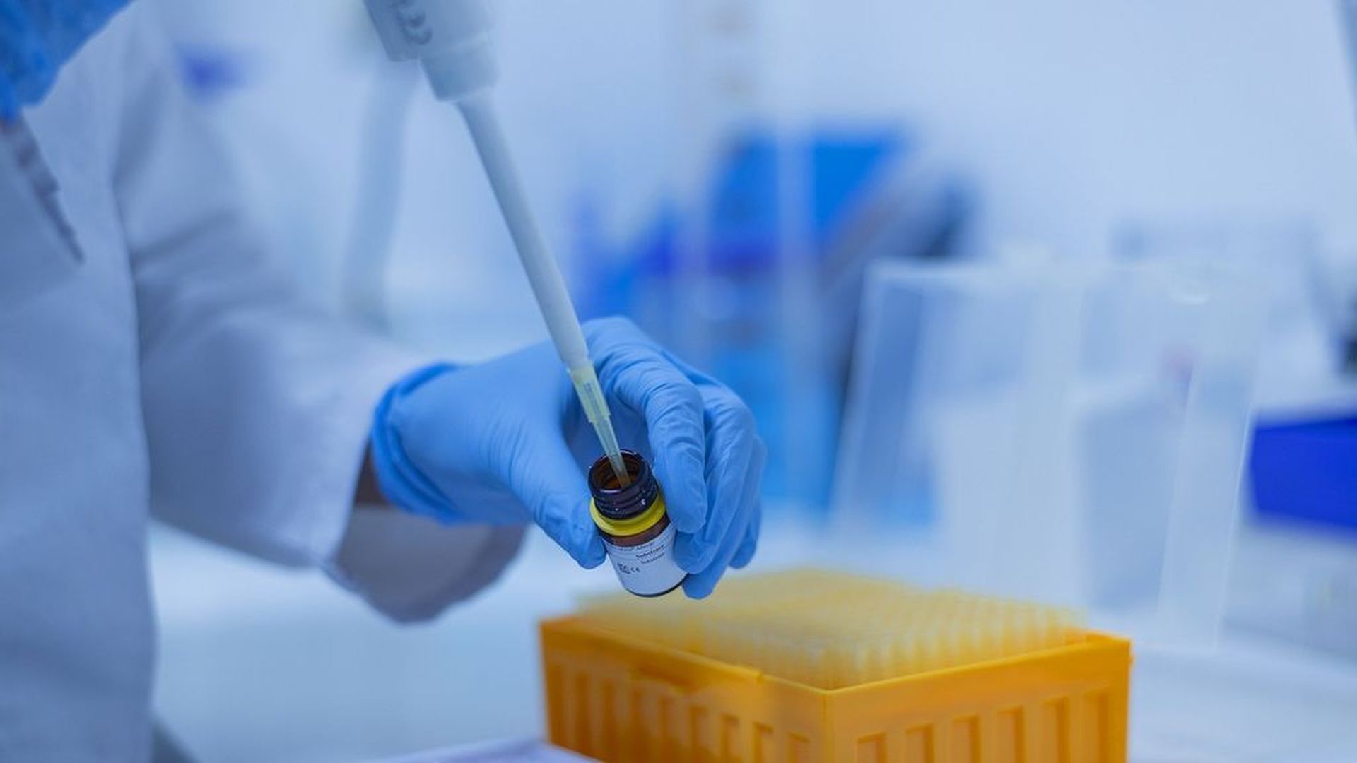 Nuevas evidencias del letal virus Chapare: es similar al ébola y puede contagiarse de persona a persona Nuevas evidencias del letal virus Chapare: es similar al ébola y puede contagiarse de persona a persona