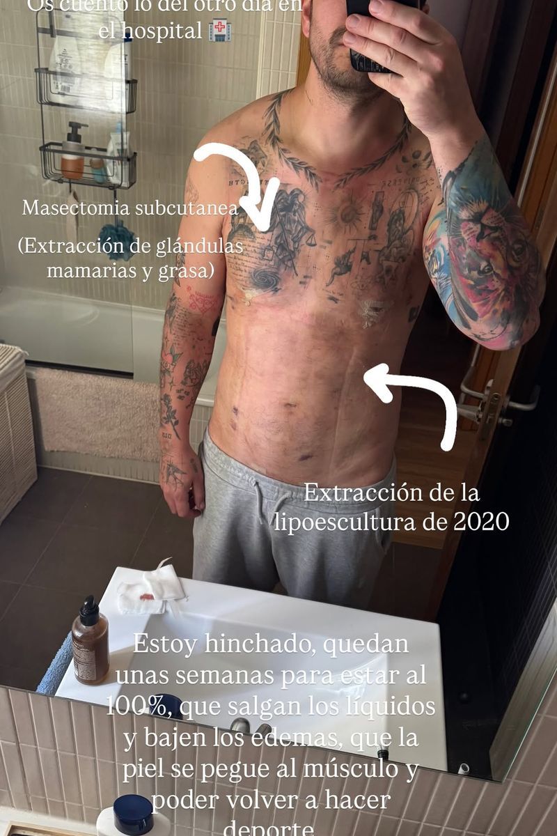Diego Matamoros enseña las cicatrices de su cuerpo