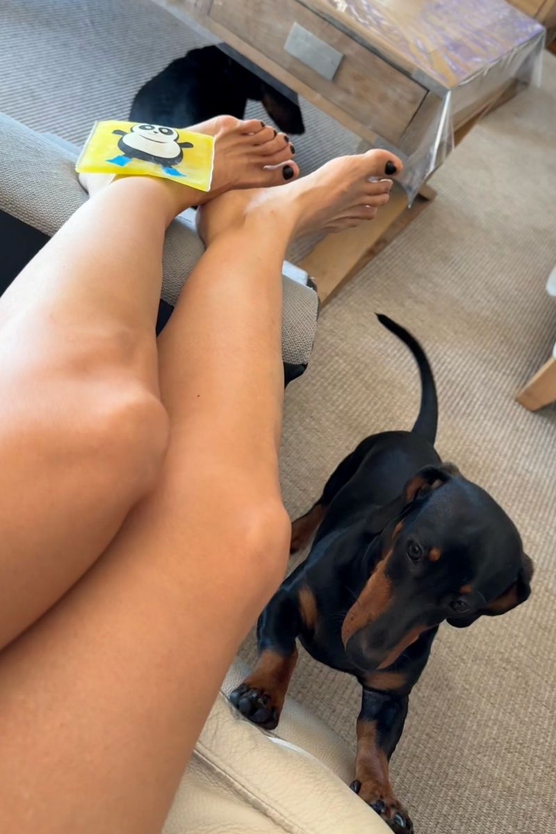 Mónica Carrillo con hielo en el pie