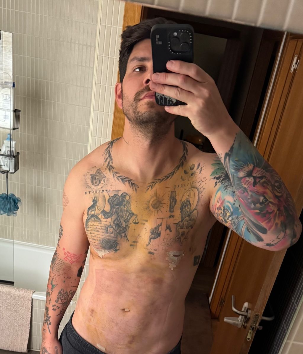 Diego Matamoros enseña el resultado de su cirugía de estética