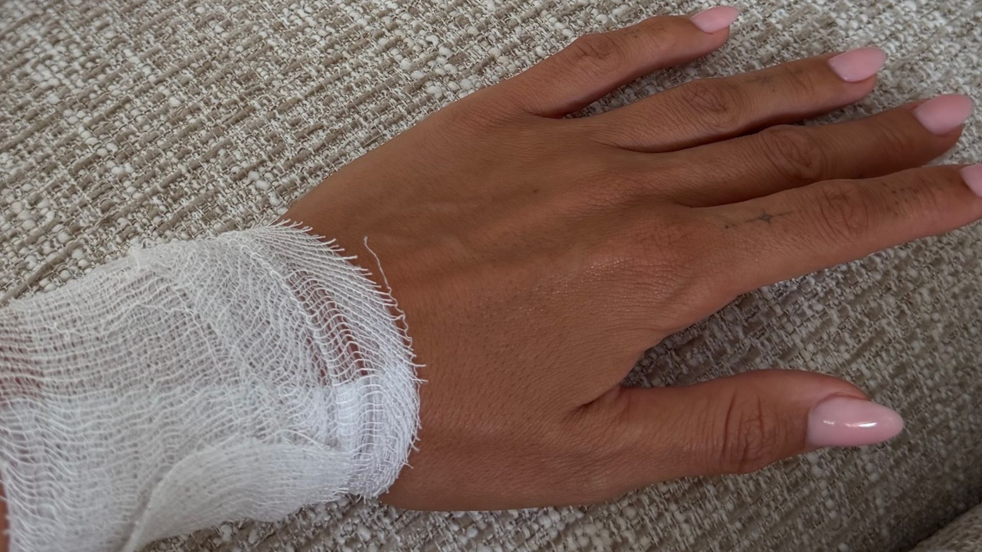 La mano de Estela Grande tras acudir al médico