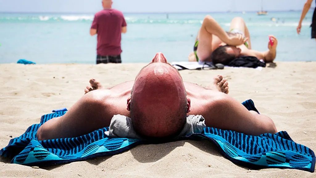Tomando el sol sin cuidar la calva