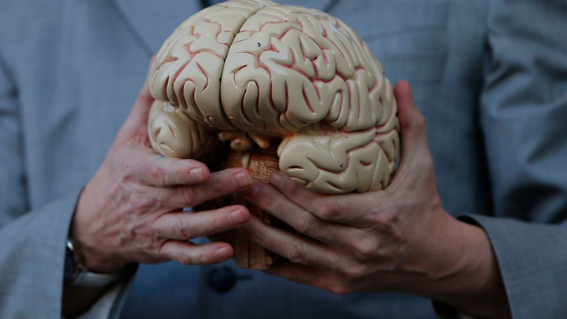 Cerebro