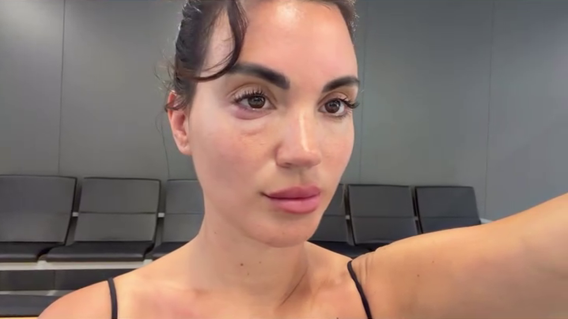 Melodie Peñalver con la cara deforme