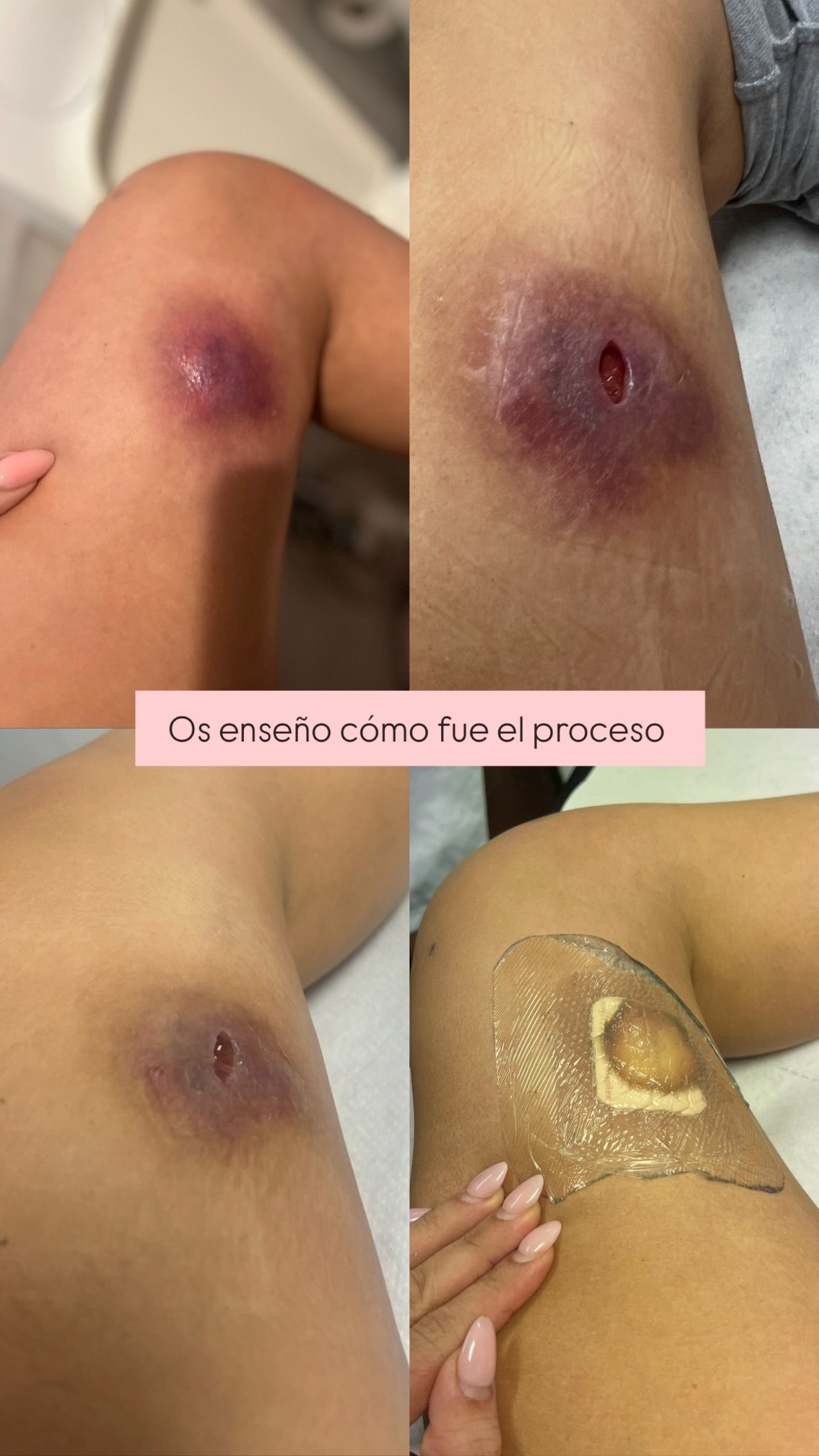 Las imágenes de la incisión que le hicieron a Daniela