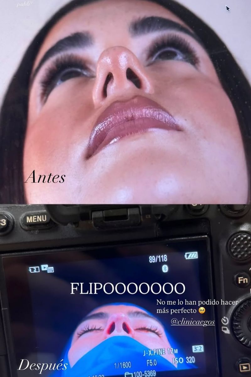 El antes y después de la operación