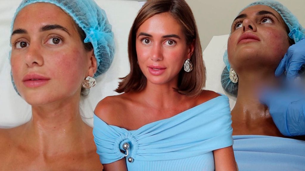 Maica Benedicto se inyecta esperma de salmón en el rostro y cuello Obvio microbio Temporada 1 Top Vídeos 35