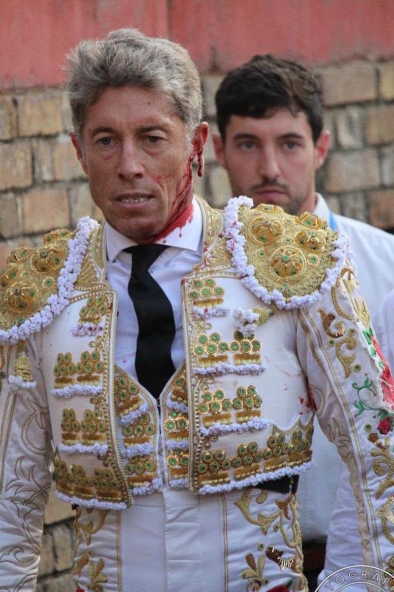 Manuel Escribano tuvo que ser intervenido de urgencia tras el desgarro de su oreja izquierda debido al choque con el toro