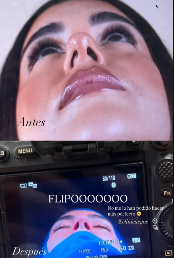 El antes y después de la operación de Helena