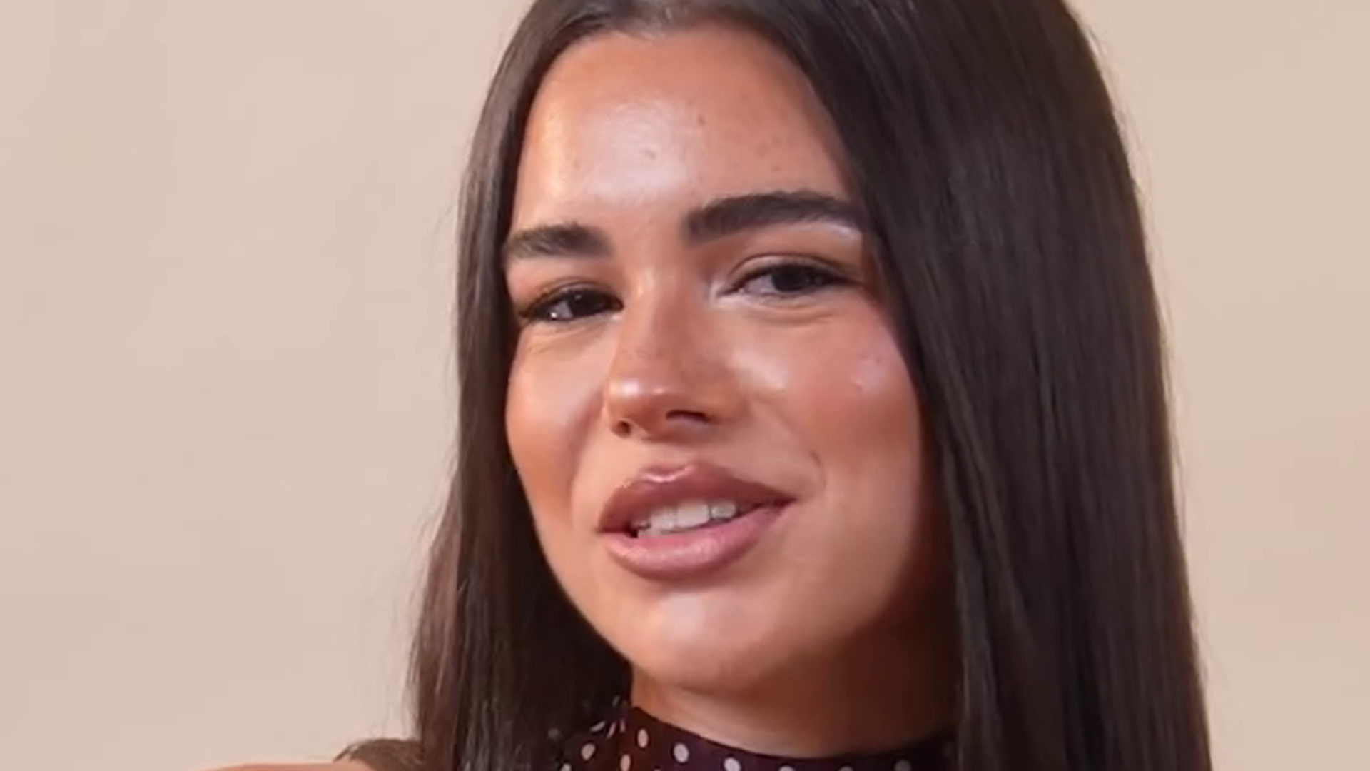 Helena Arauz se somete a una rinoseptoplastia debido a una asimetría Helena Arauz se somete a una rinoseptoplastia debido a una asimetría