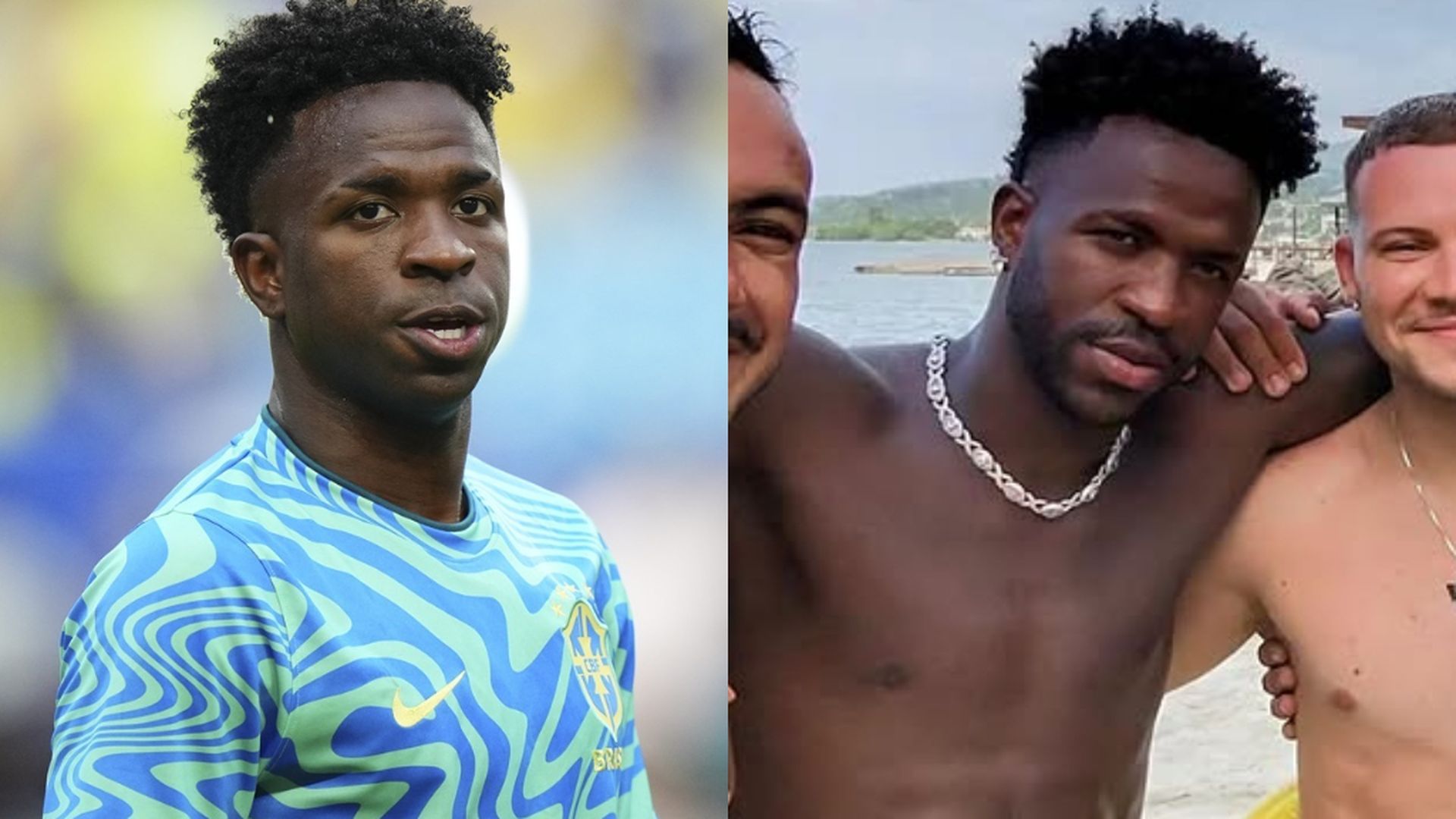 El antes y después de Vinicius Jr, tras haberse sometido a una mentoplastia