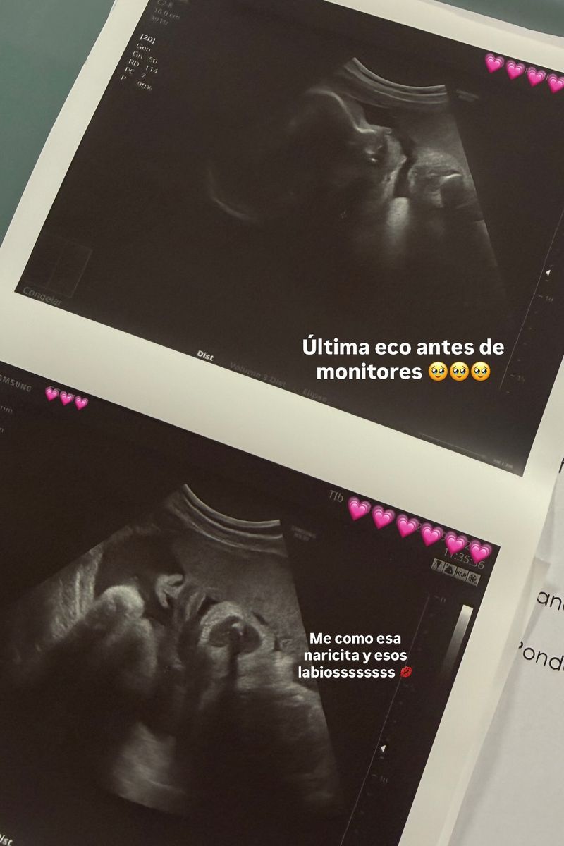 La última ecografía de Valentina