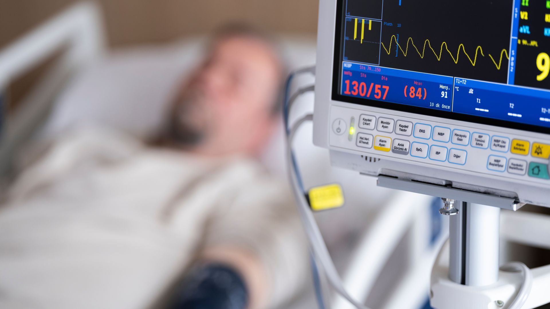 Un paciente conectado a un soporte vital en un hospital Un paciente conectado a un soporte vital en un hospital