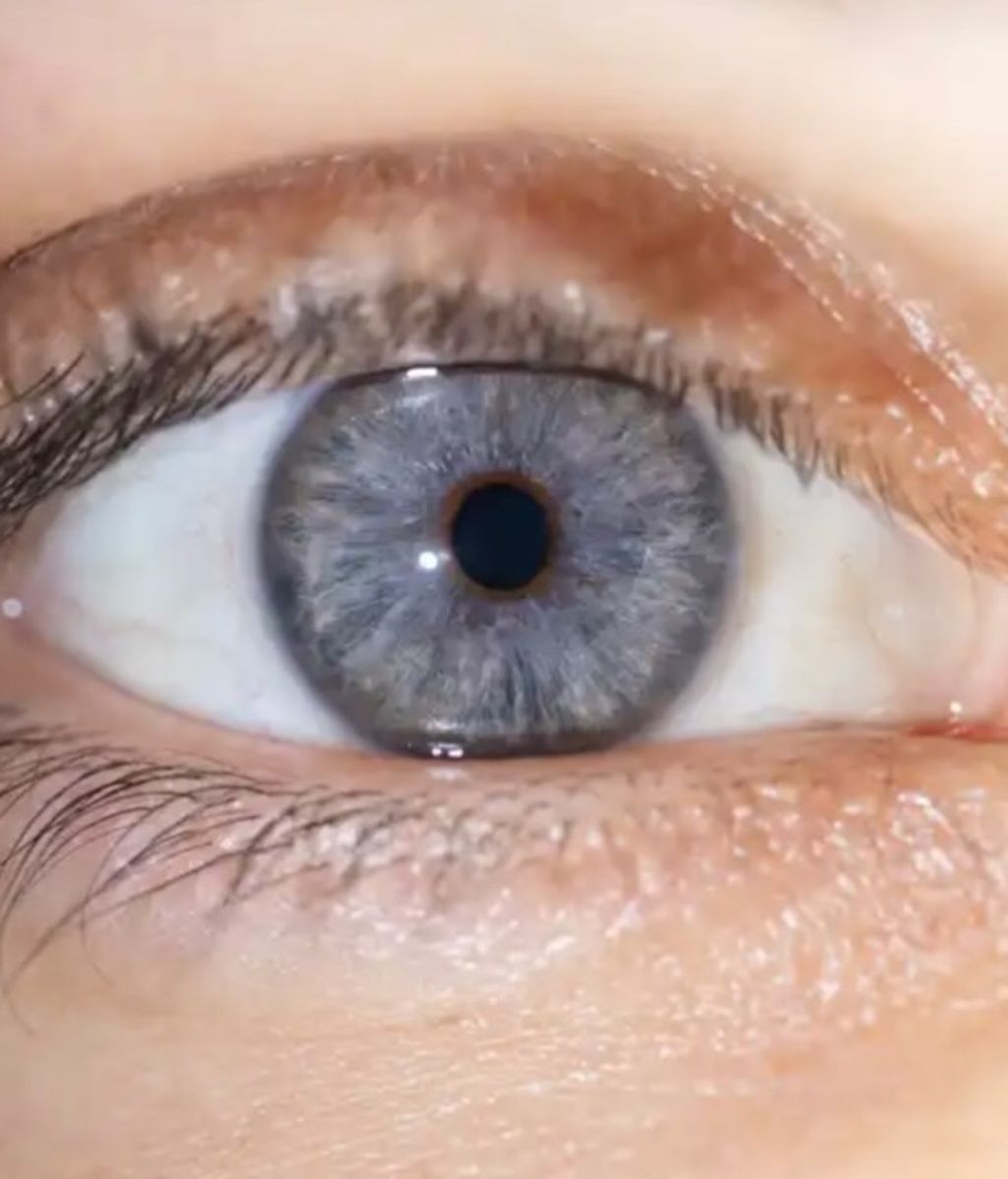 El color de ojos actual de Álvaro Rubio tras el tratamiento