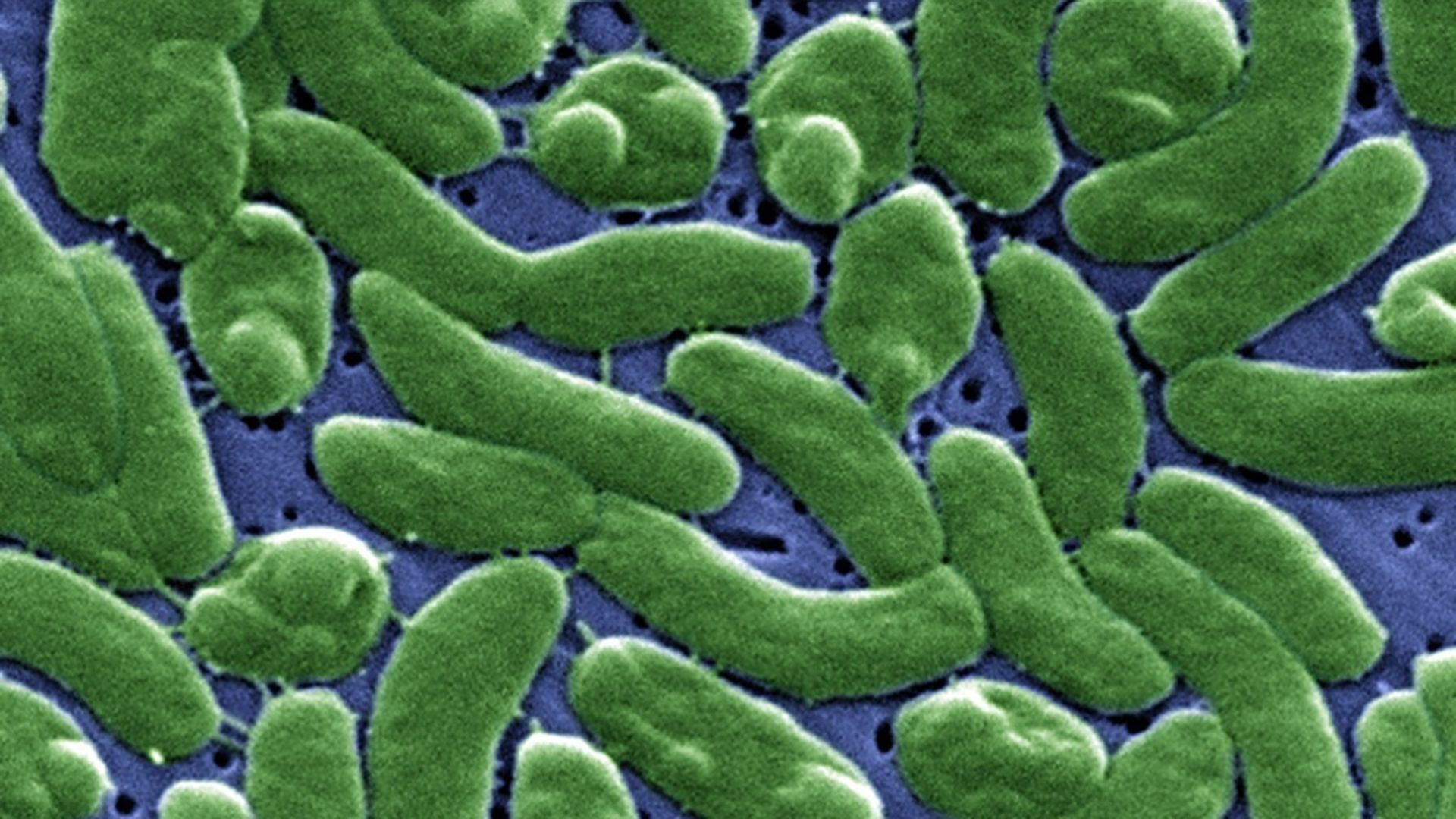 Imagen al microscopio, coloreada, de la bacteria 'Vibrio vulnificus'. Imagen al microscopio, coloreada, de la bacteria 'Vibrio vulnificus'.