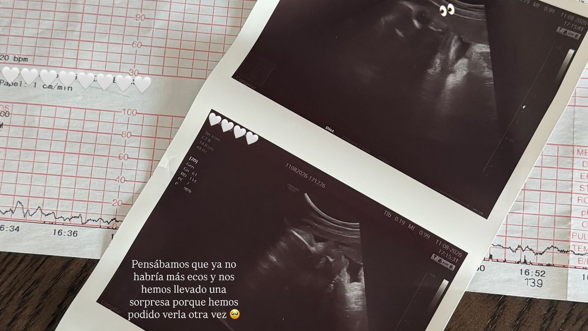 Una de las últimas ecografías de Valentina
