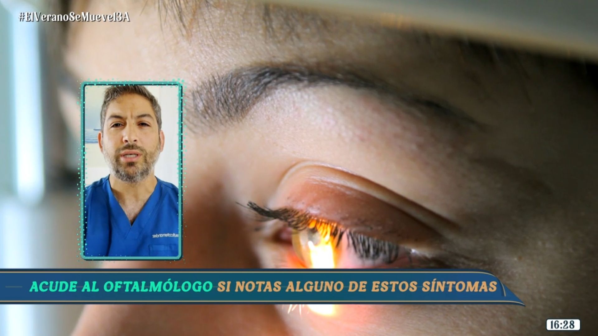 Las consecuencias que pueden aparecer en tus ojos si no has tomado las advertencias adecuadas durante el eclipse Las consecuencias que pueden aparecer en tus ojos si no has tomado las advertencias adecuadas durante el eclipse