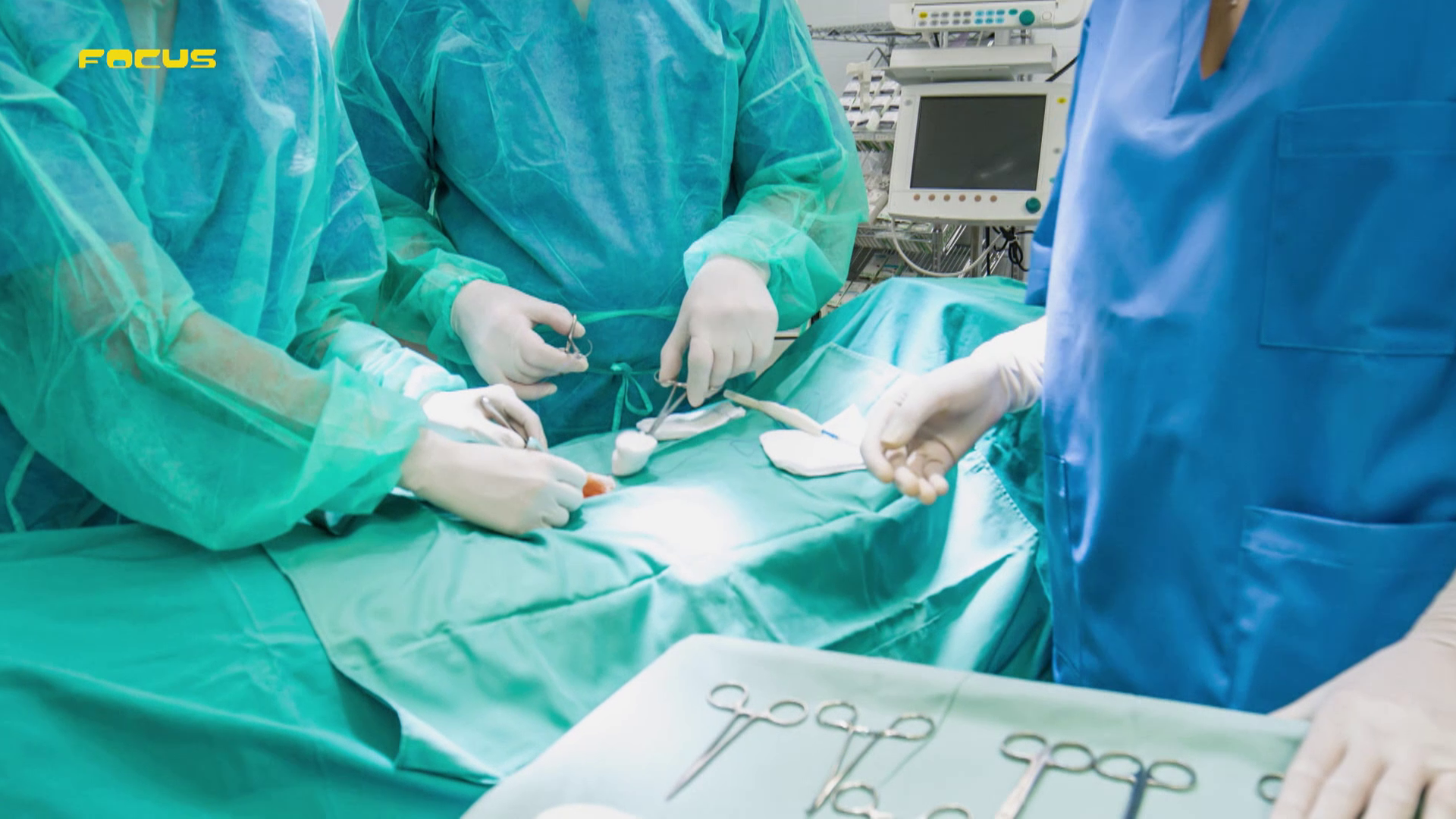 Tratamientos extremos en busca del cuerpo perfecto: la cirugía de la Cenicienta o la umbilicoplastia Tratamientos extremos en busca del cuerpo perfecto: la cirugía de la Cenicienta o la umbilicoplastia
