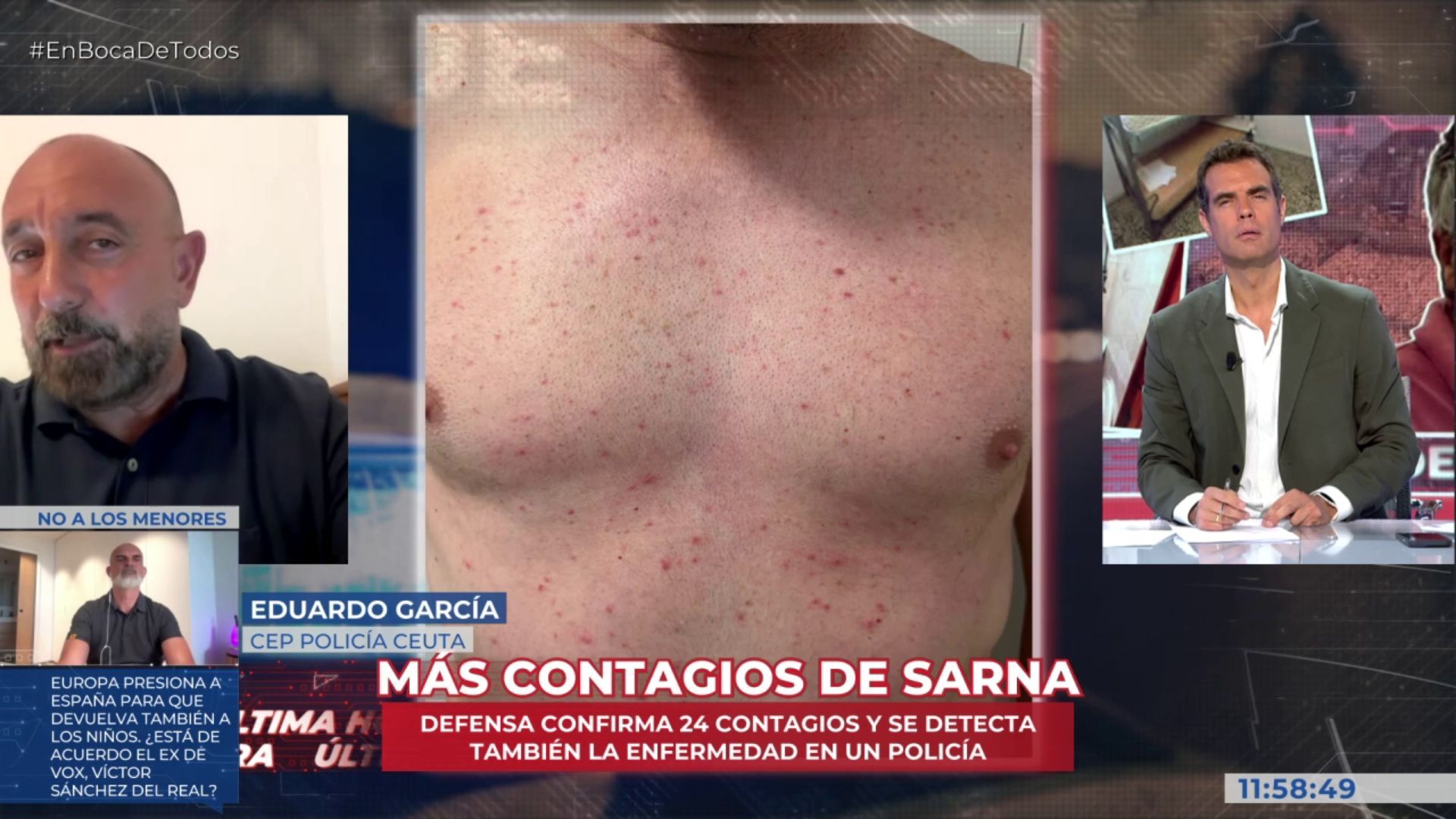 Dos policías contagiados de sarna, según el portavoz del sindicato policial