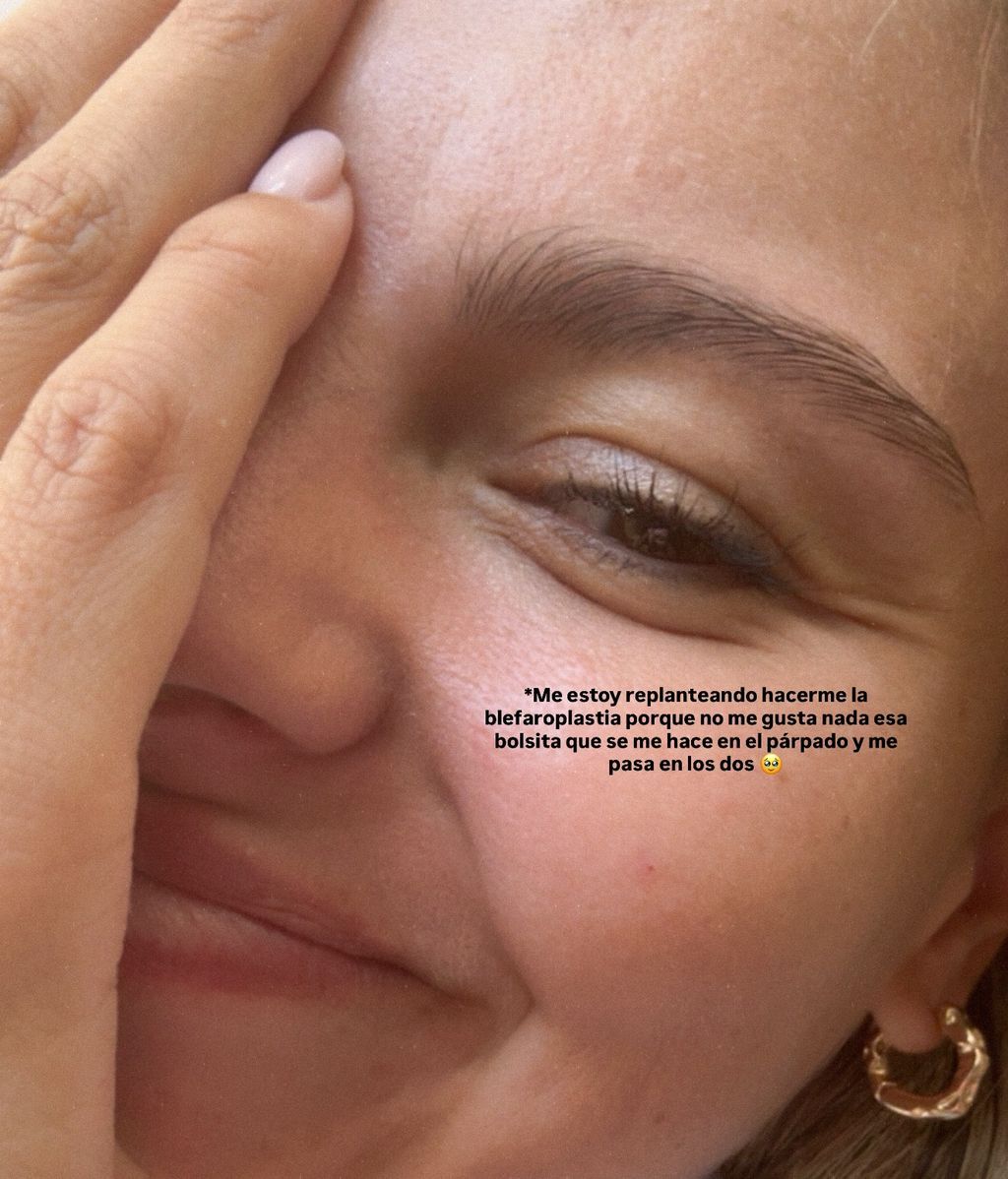 La foto que Andra Arpal ha compartido de su ojo