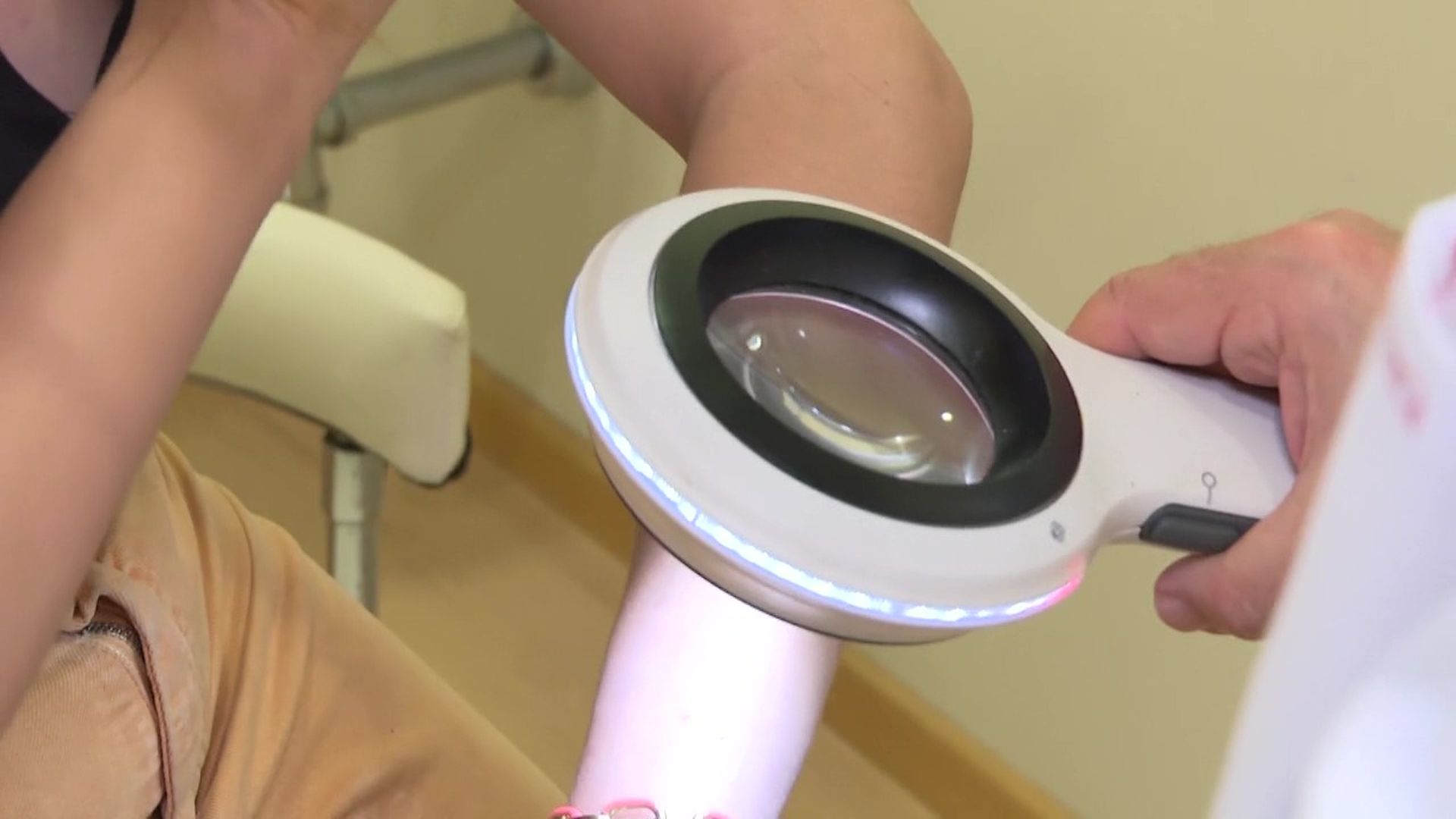 Vacuna contra el melanoma Vacuna contra el melanoma