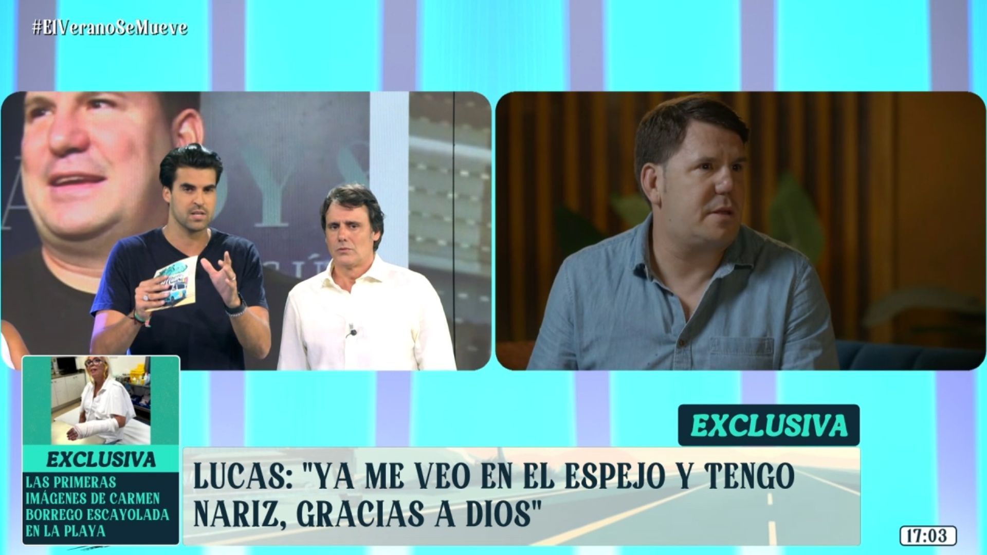 Todos los detalles de la segunda operación de nariz de Lucas: "Va a emprender un nuevo proyecto y seguramente incluya todo este proceso" Todos los detalles de la segunda operación de nariz de Lucas: "Va a emprender un nuevo proyecto y seguramente incluya todo este proceso"