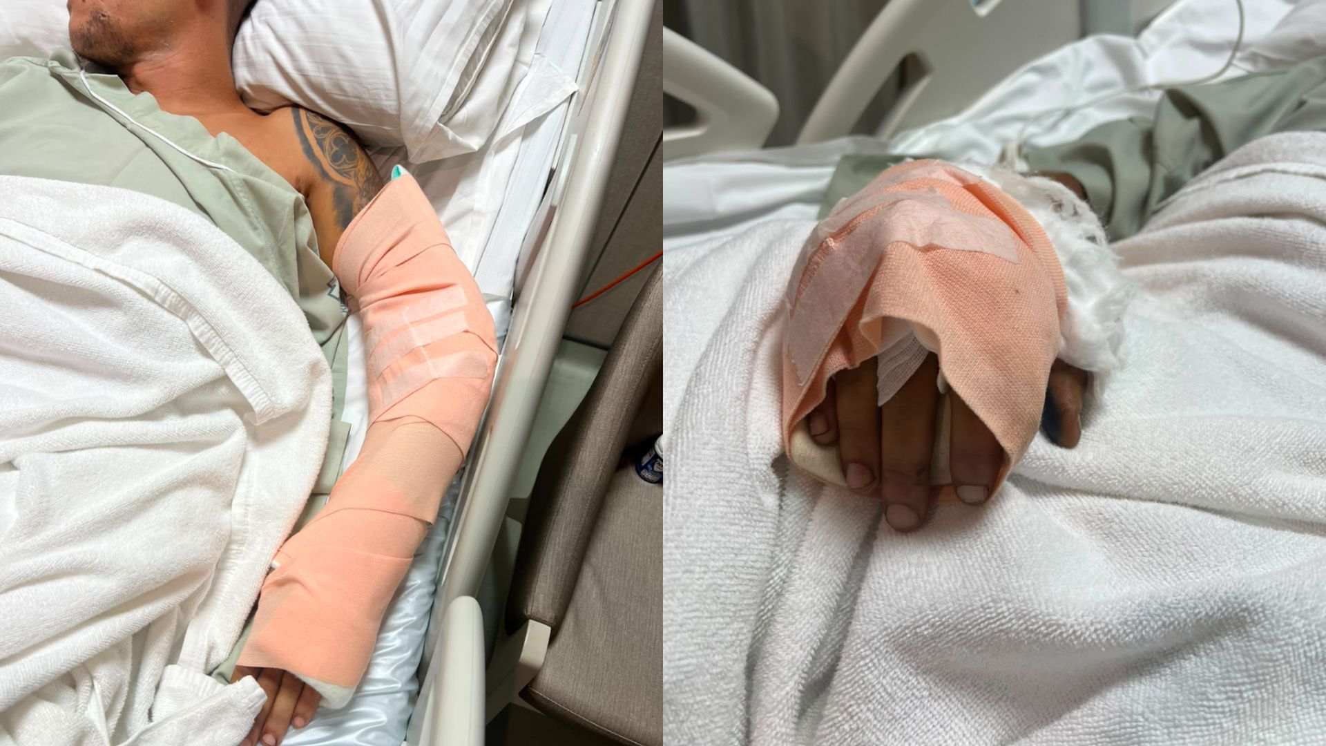 Las heridas que ha sufrido Marc Campo