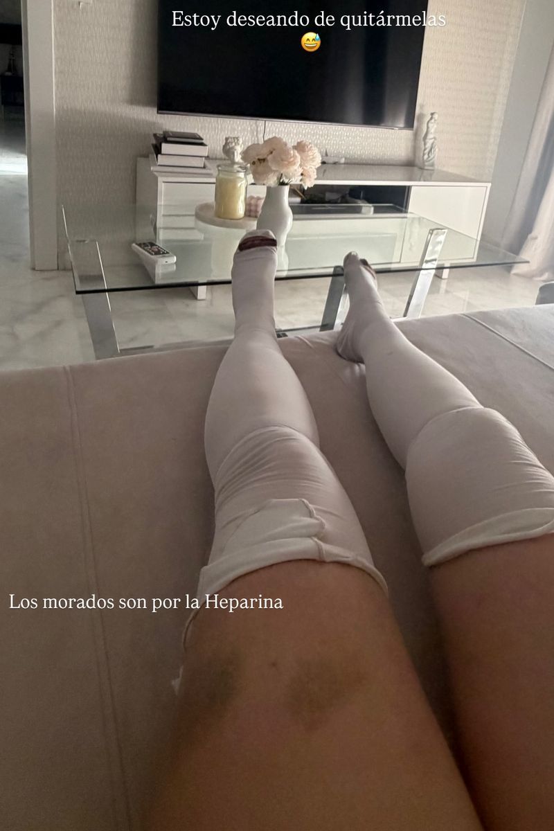 Inma muestra el estado de sus piernas