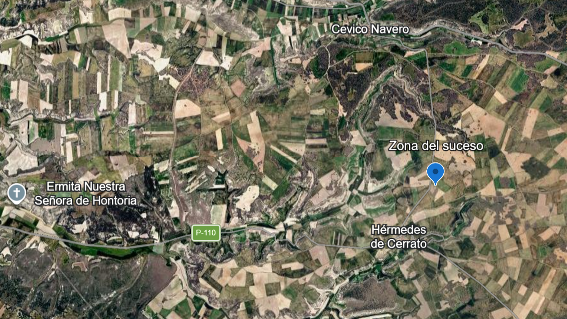 Zona donde recibió el disparo la cazadora Raquel García