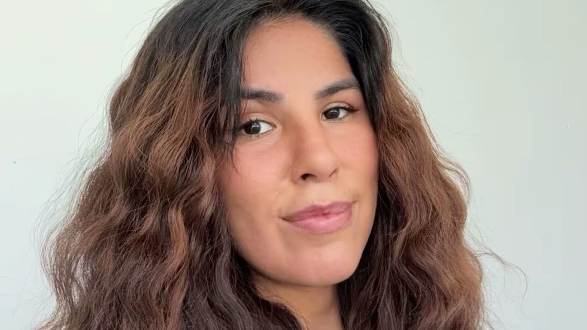 Isa Pantoja enseña las manchas que le han salido en la cara Isa Pantoja enseña las manchas que le han salido en la cara