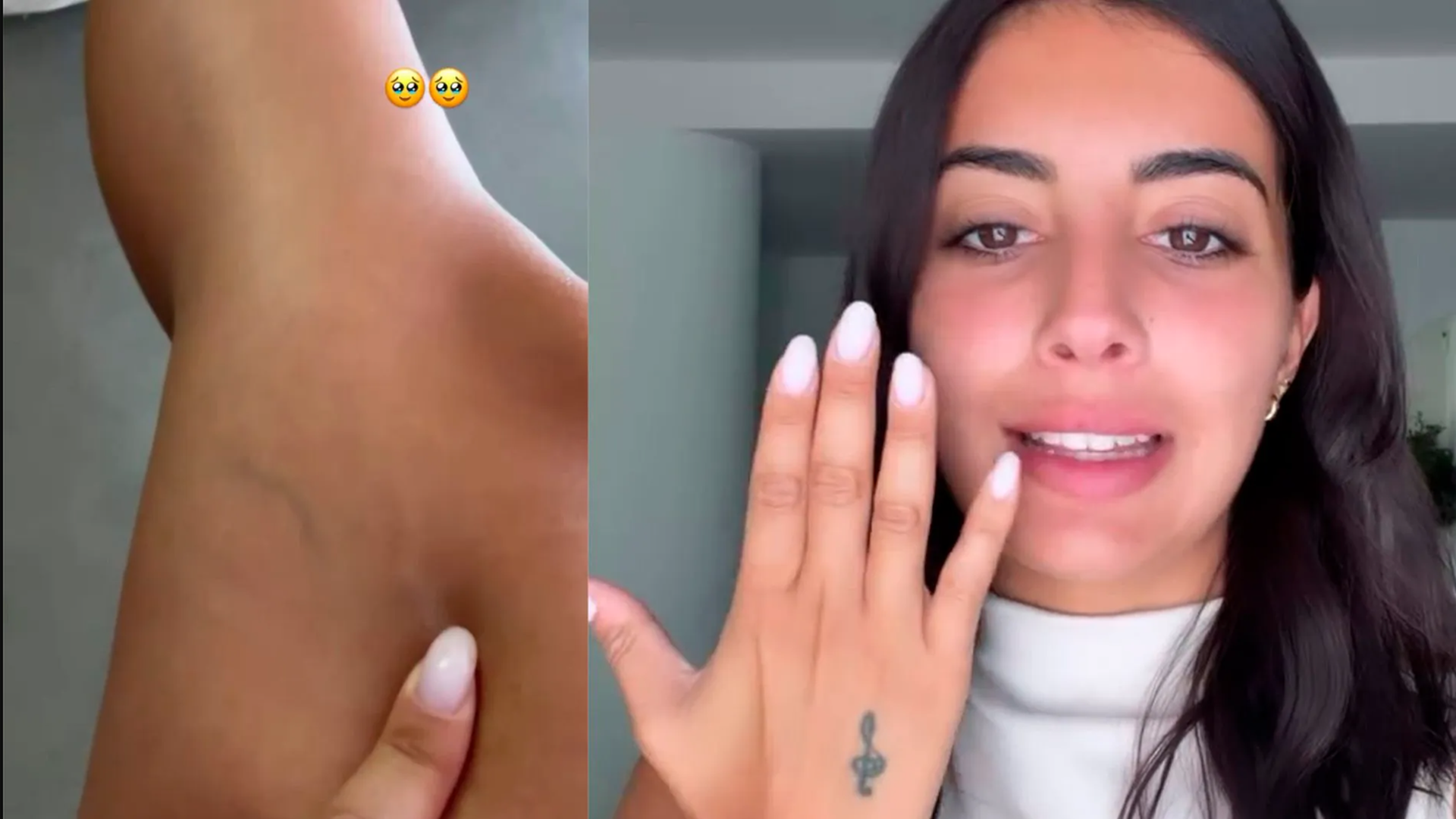 Las imágenes que publicó Marieta para enseñar cómo tiene sus manos y piernas