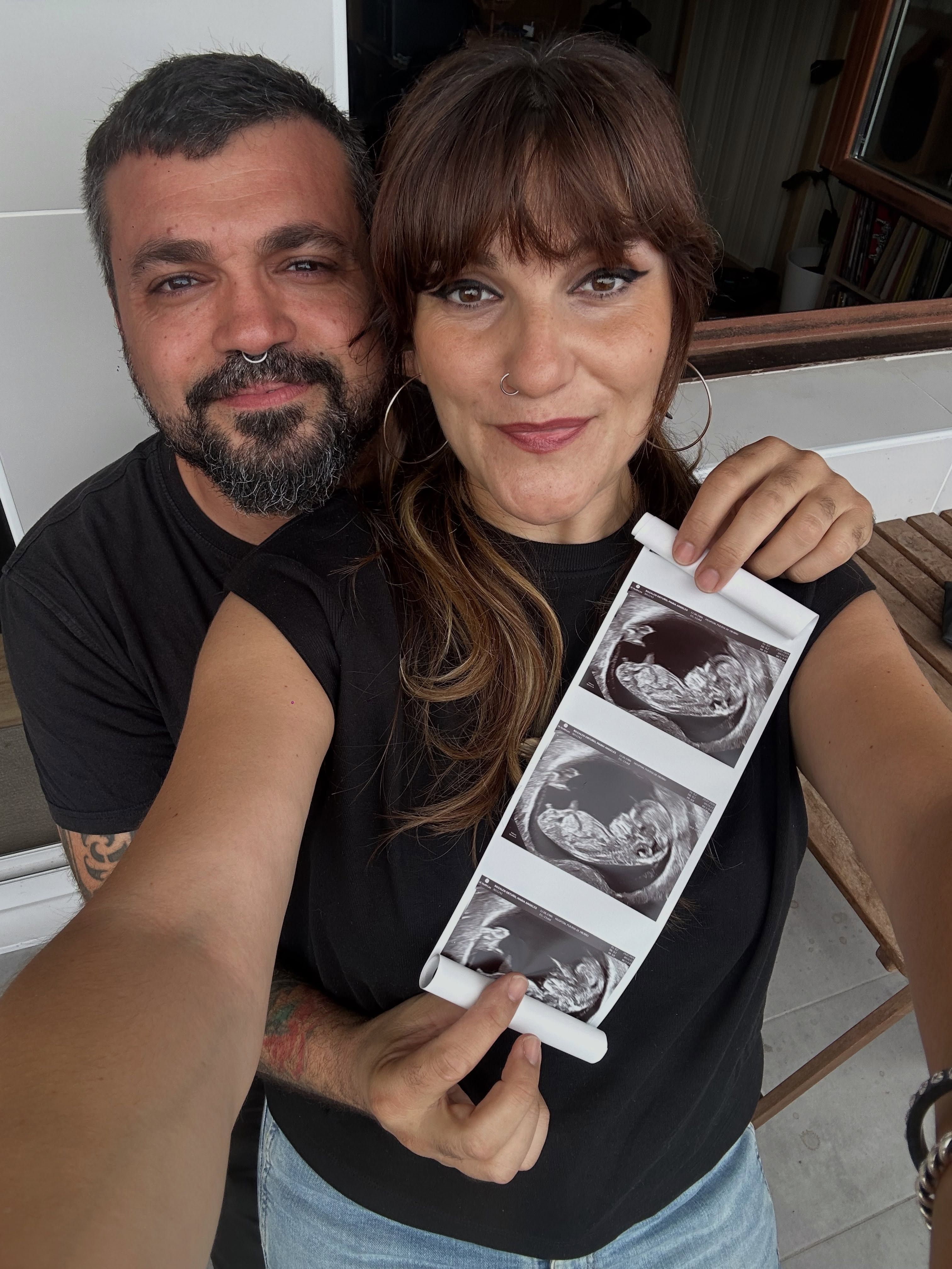Rozalen y su pareja, anunciando su embarazo