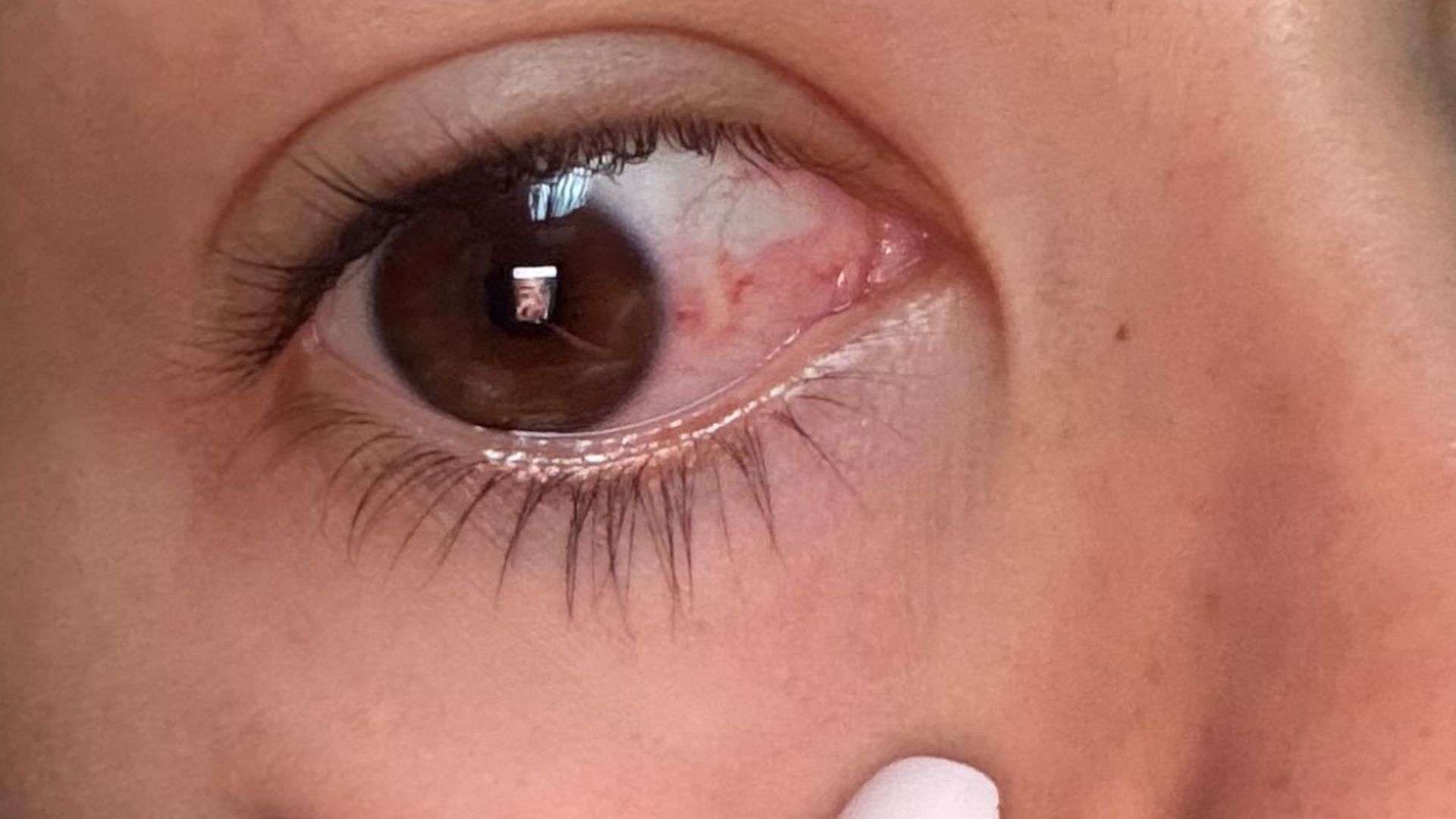 El estado del ojo izquierdo de Tania Déniz
