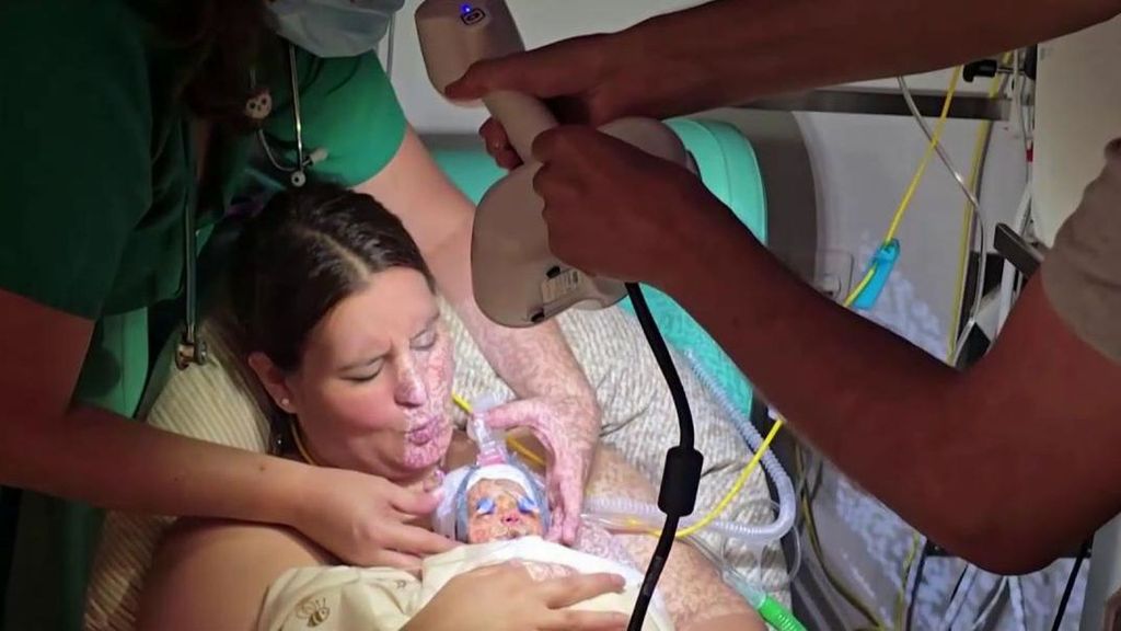 Adán, un bebé prematuro, ya tiene su mascarilla a la medida en 3D para poder respirar gracias al 12 de Octubre