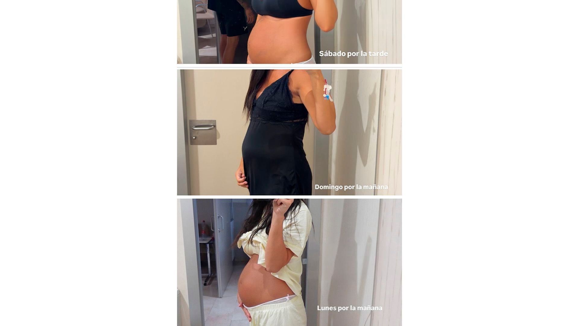 La barriga de Claudia Martínez los primeros días de postparto