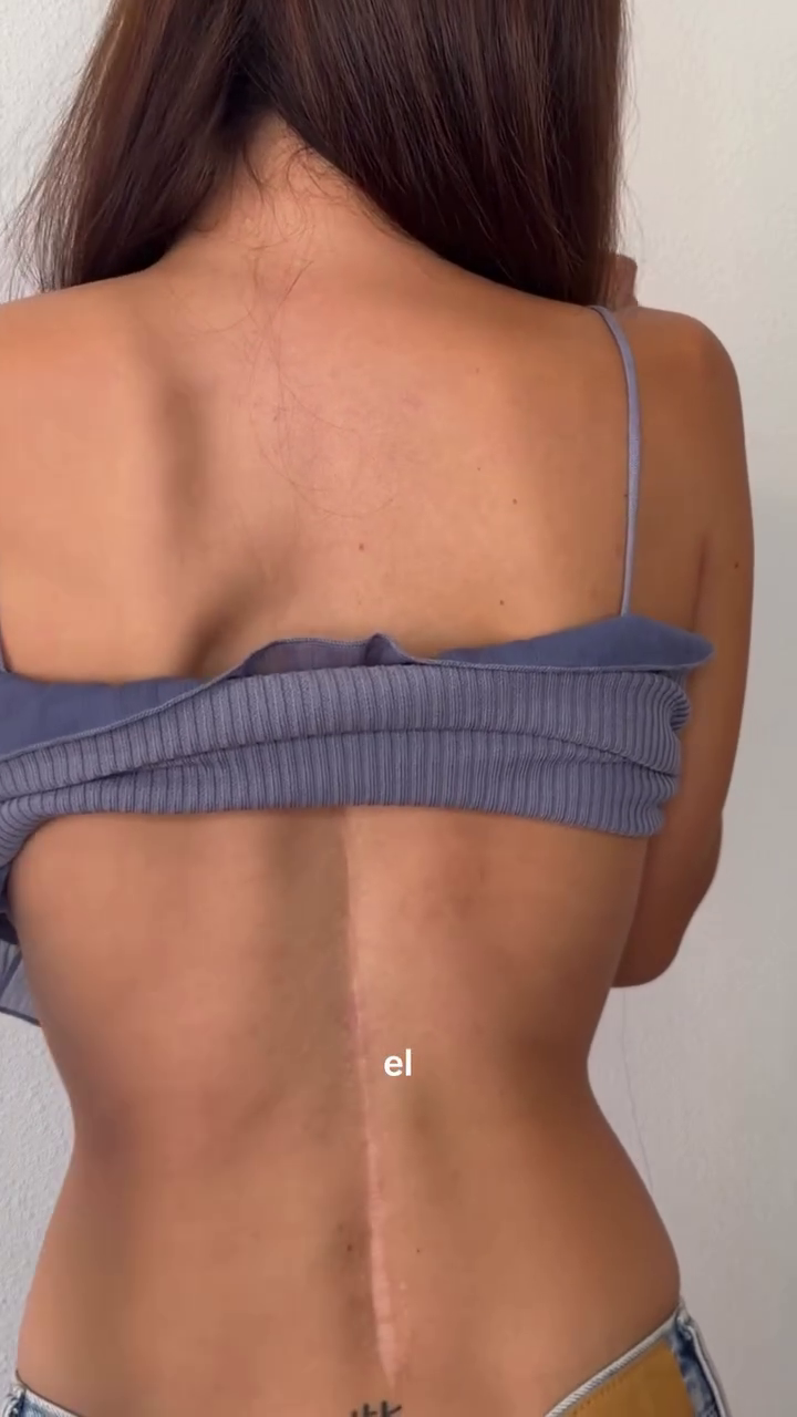 La cicatriz de Julia